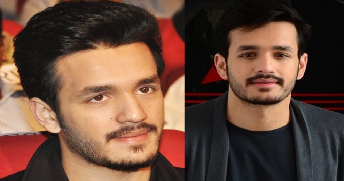 akkineni-akhil-going-to-abroad-for-plastic-surgery