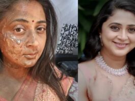 what-happened-to-kanika-subramaniam-face-full-of-burns